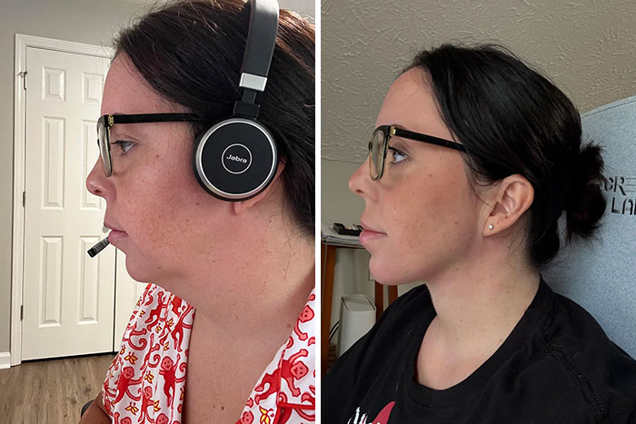 80 Plastic Surgery Transformations That Changed Ordinary Lives Forever