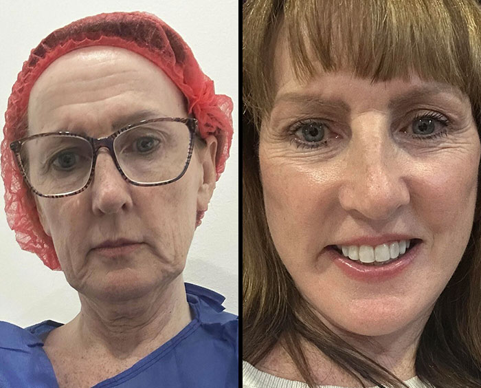 80 Plastic Surgery Transformations That Changed Ordinary Lives Forever
