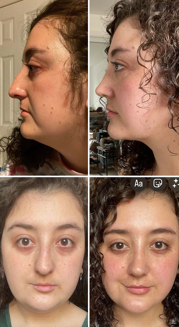 80 Plastic Surgery Transformations That Changed Ordinary Lives Forever
