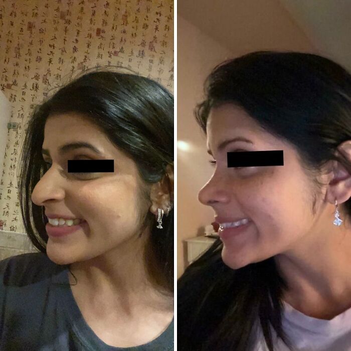 80 Plastic Surgery Transformations That Changed Ordinary Lives Forever