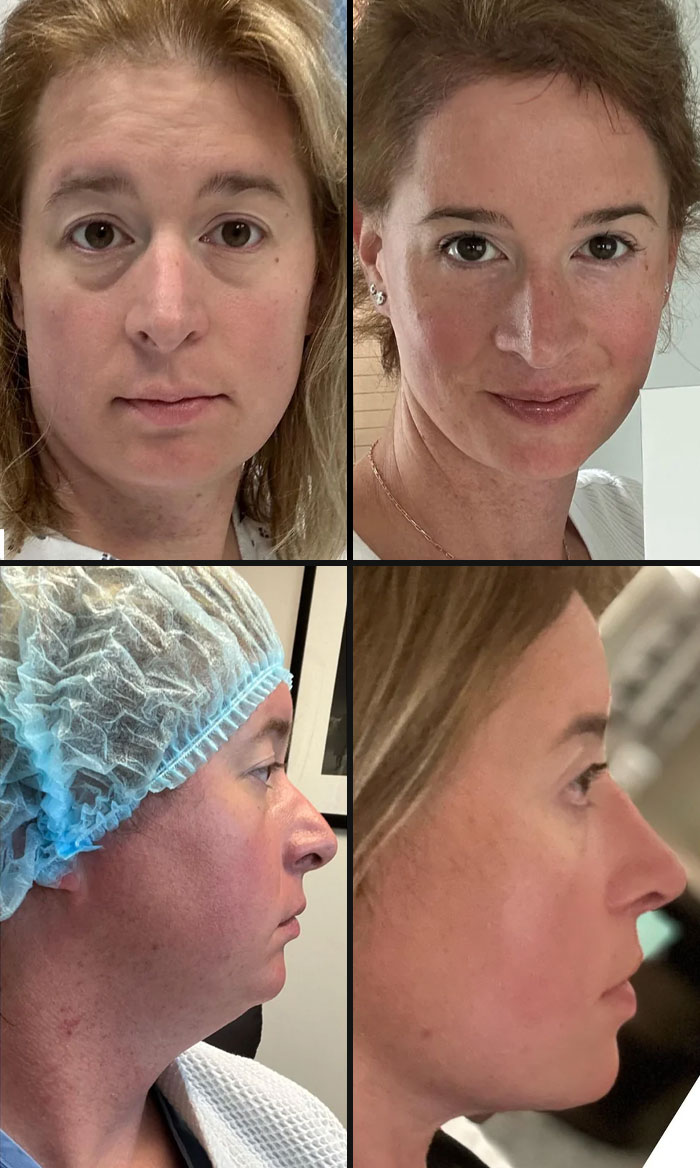 80 Plastic Surgery Transformations That Changed Ordinary Lives Forever