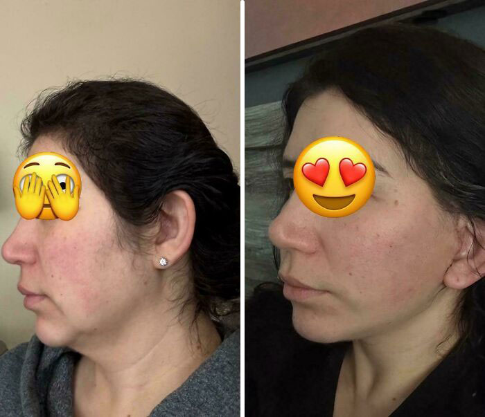 80 Plastic Surgery Transformations That Changed Ordinary Lives Forever