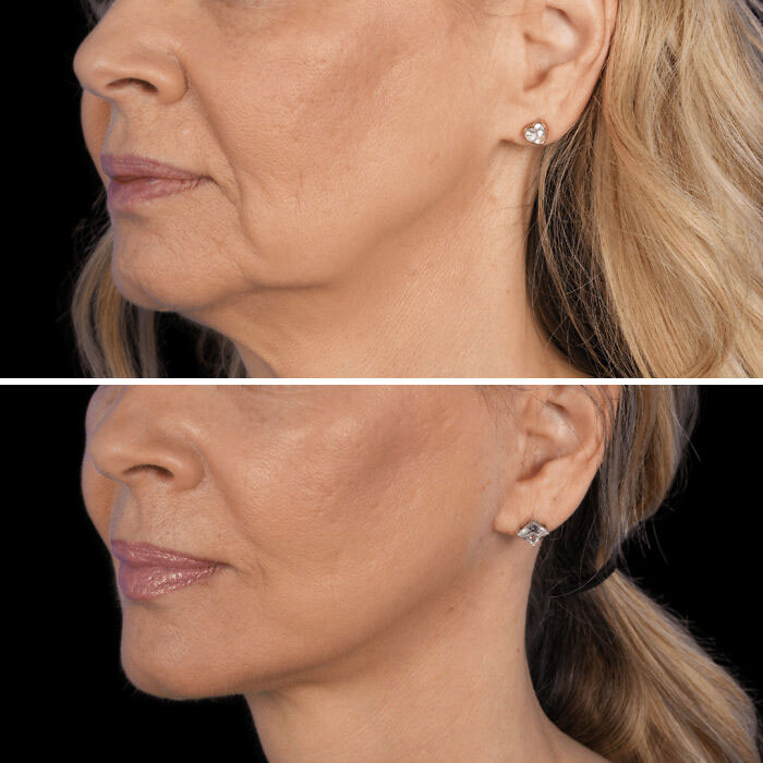 80 Plastic Surgery Transformations That Changed Ordinary Lives Forever