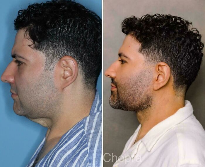 80 Plastic Surgery Transformations That Changed Ordinary Lives Forever