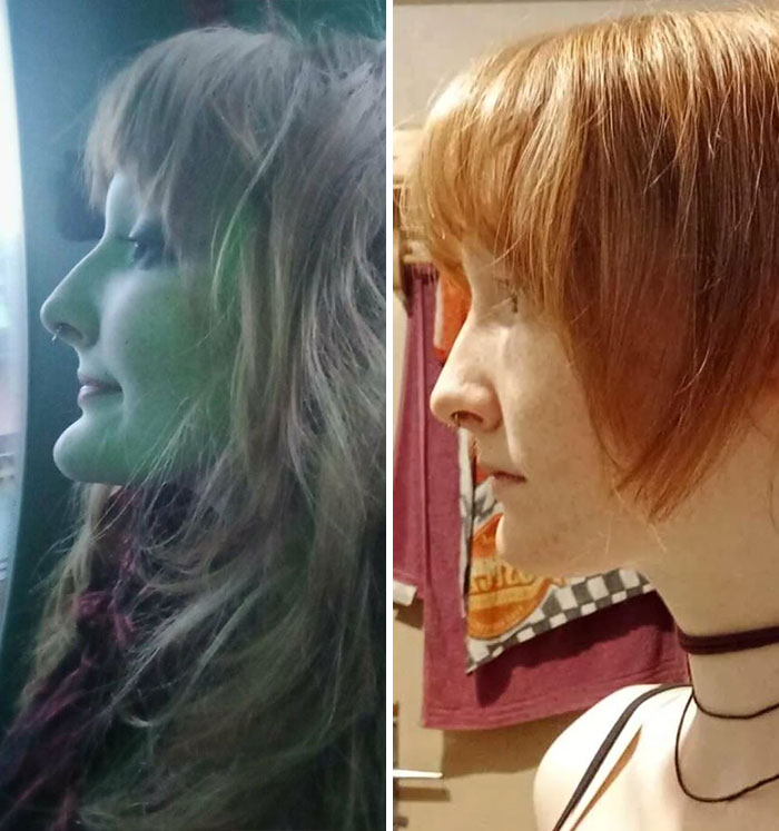 80 Plastic Surgery Transformations That Changed Ordinary Lives Forever