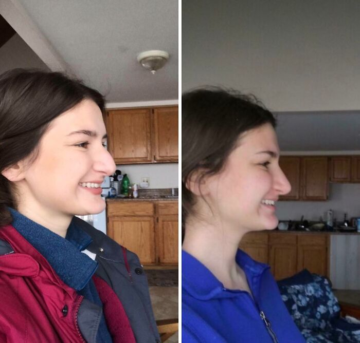 80 Plastic Surgery Transformations That Changed Ordinary Lives Forever