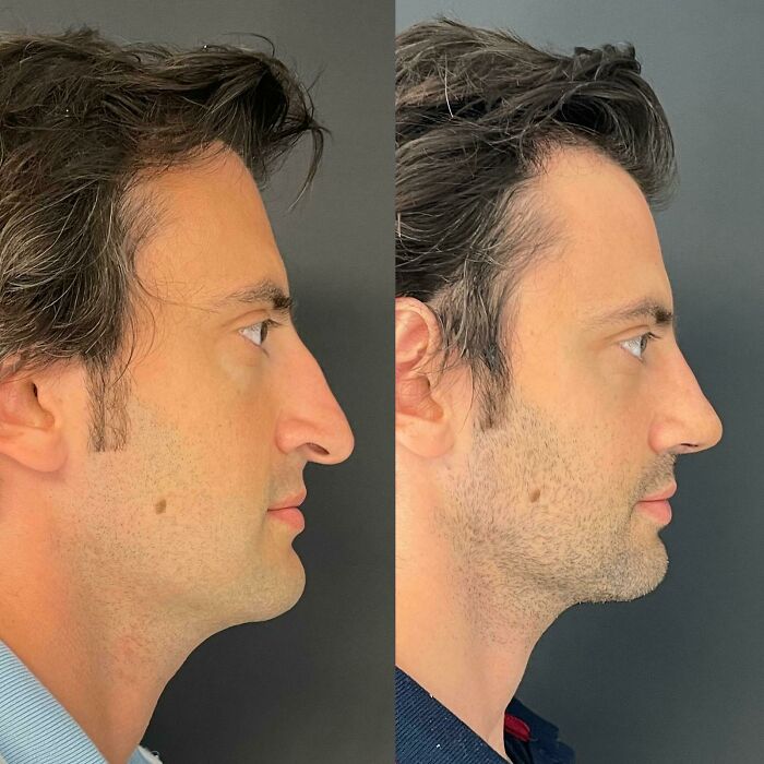 80 Plastic Surgery Transformations That Changed Ordinary Lives Forever