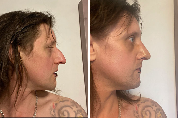 80 Plastic Surgery Transformations That Changed Ordinary Lives Forever