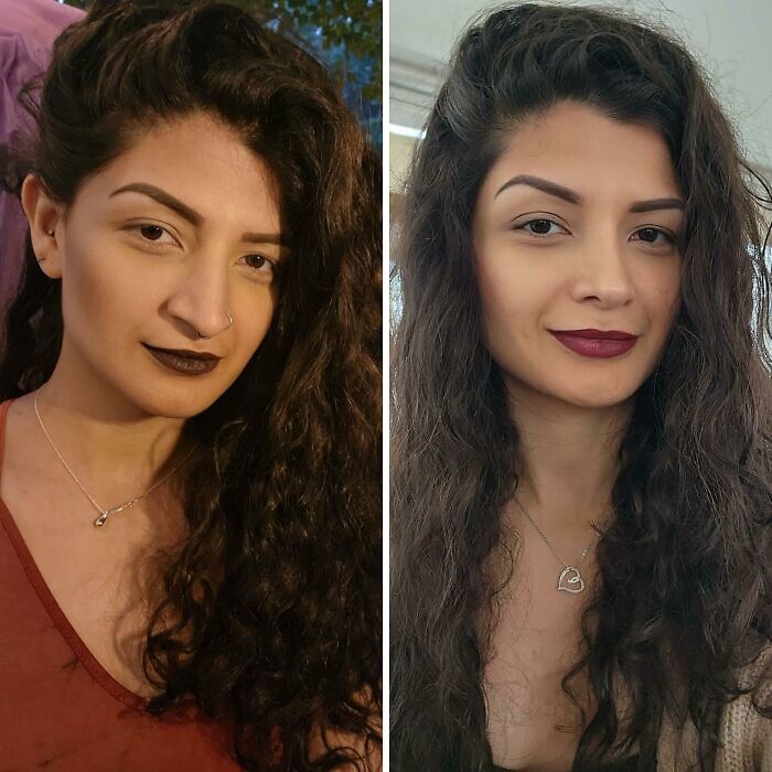 80 Plastic Surgery Transformations That Changed Ordinary Lives Forever