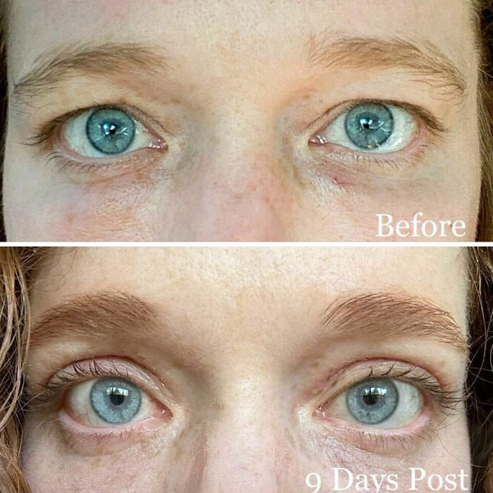80 Plastic Surgery Transformations That Changed Ordinary Lives Forever