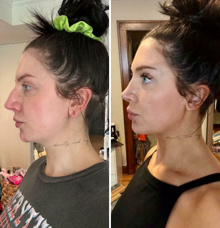 80 Plastic Surgery Transformations That Changed Ordinary Lives Forever