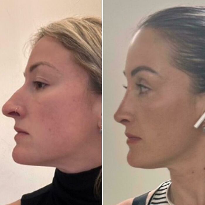 80 Plastic Surgery Transformations That Changed Ordinary Lives Forever