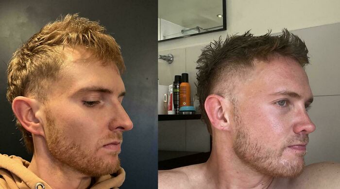 80 Plastic Surgery Transformations That Changed Ordinary Lives Forever