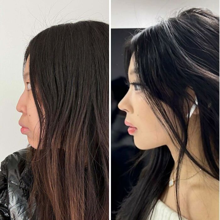 80 Plastic Surgery Transformations That Changed Ordinary Lives Forever