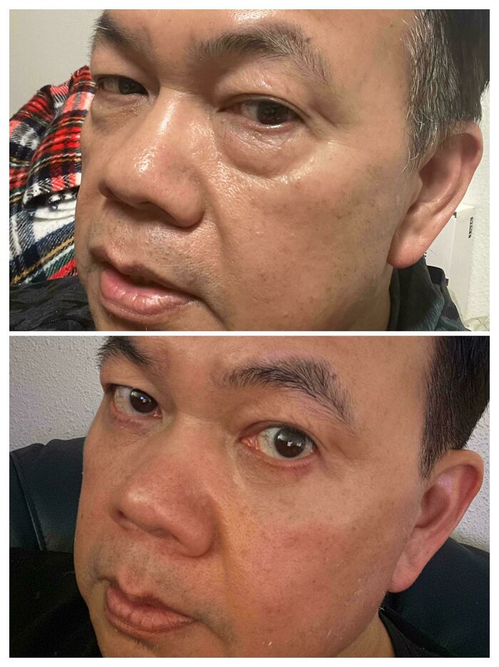 80 Plastic Surgery Transformations That Changed Ordinary Lives Forever
