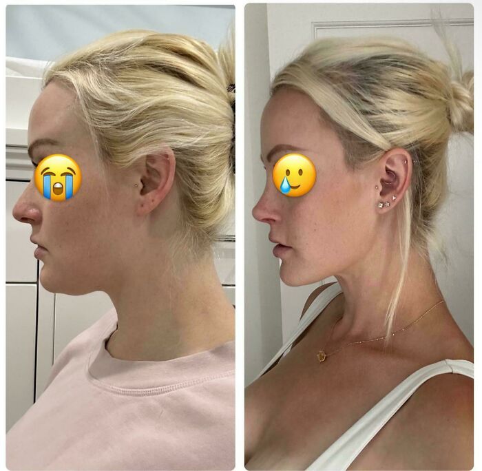 80 Plastic Surgery Transformations That Changed Ordinary Lives Forever