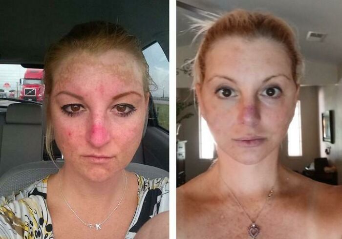 80 Plastic Surgery Transformations That Changed Ordinary Lives Forever