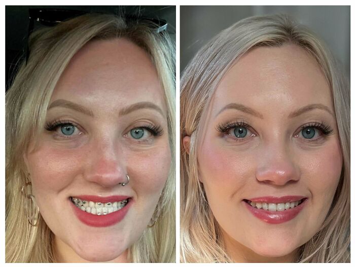 80 Plastic Surgery Transformations That Changed Ordinary Lives Forever