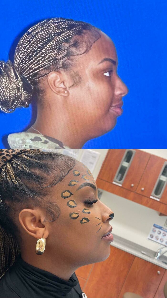 80 Plastic Surgery Transformations That Changed Ordinary Lives Forever