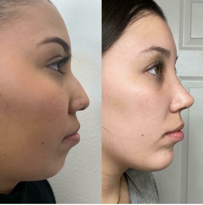 80 Plastic Surgery Transformations That Changed Ordinary Lives Forever