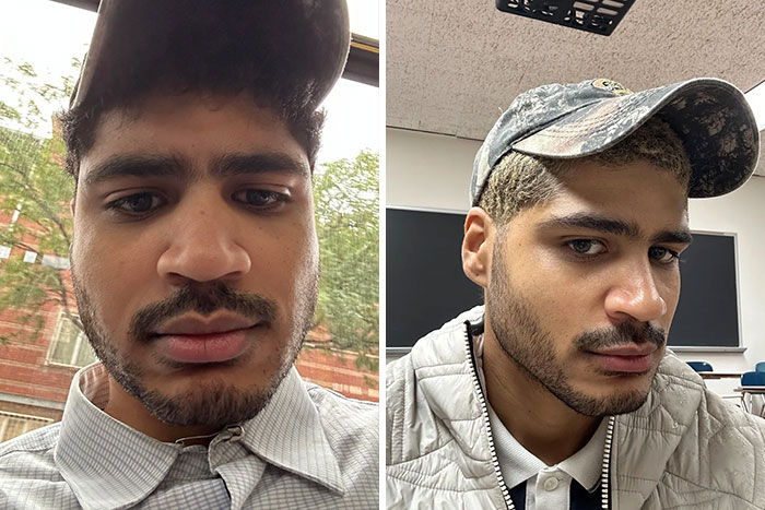 80 Plastic Surgery Transformations That Changed Ordinary Lives Forever