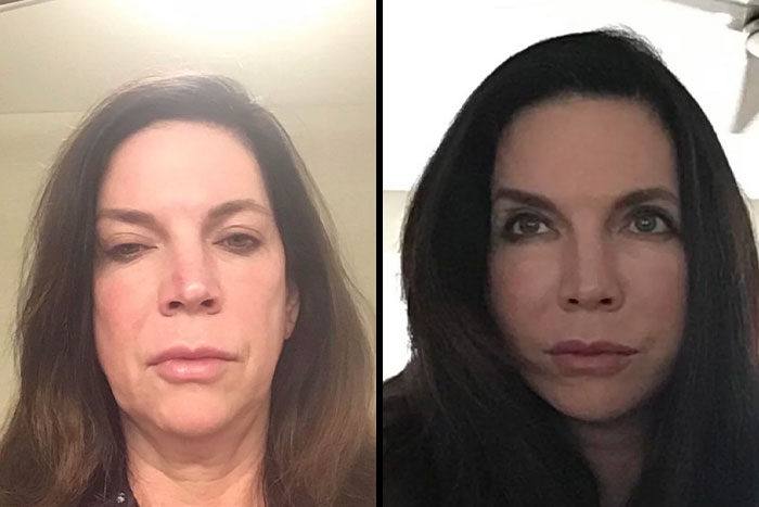 80 Plastic Surgery Transformations That Changed Ordinary Lives Forever