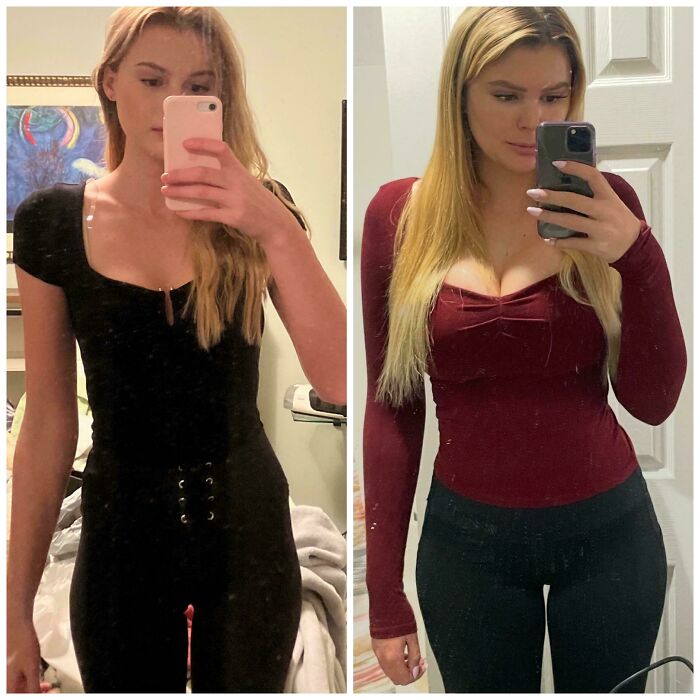 80 Plastic Surgery Transformations That Changed Ordinary Lives Forever