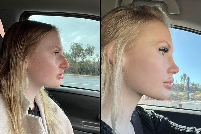 80 Plastic Surgery Transformations That Changed Ordinary Lives Forever