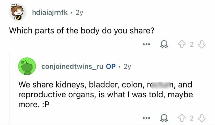 Conjoined Twins Answer The Internet’s Most Burning Questions