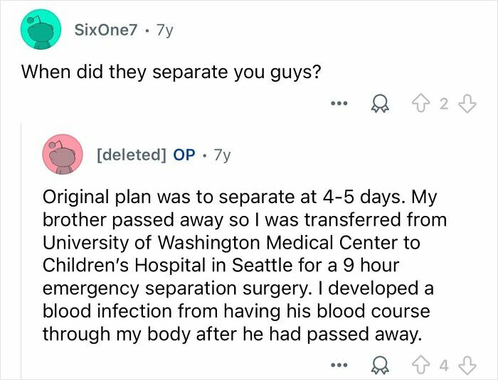 Conjoined Twins Answer The Internet’s Most Burning Questions