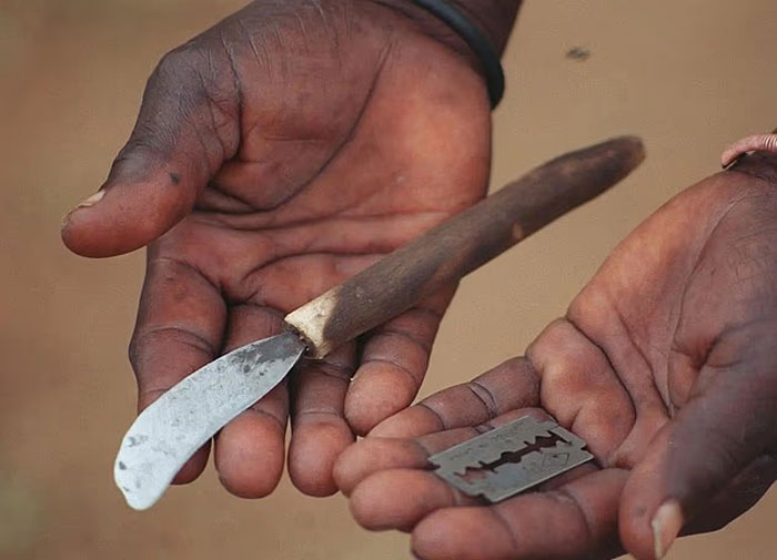 &#8216;Horrifying&#8217; Mass Circumcision Ceremony Claims Lives Of 42 Boys With Dozens More Mutilated