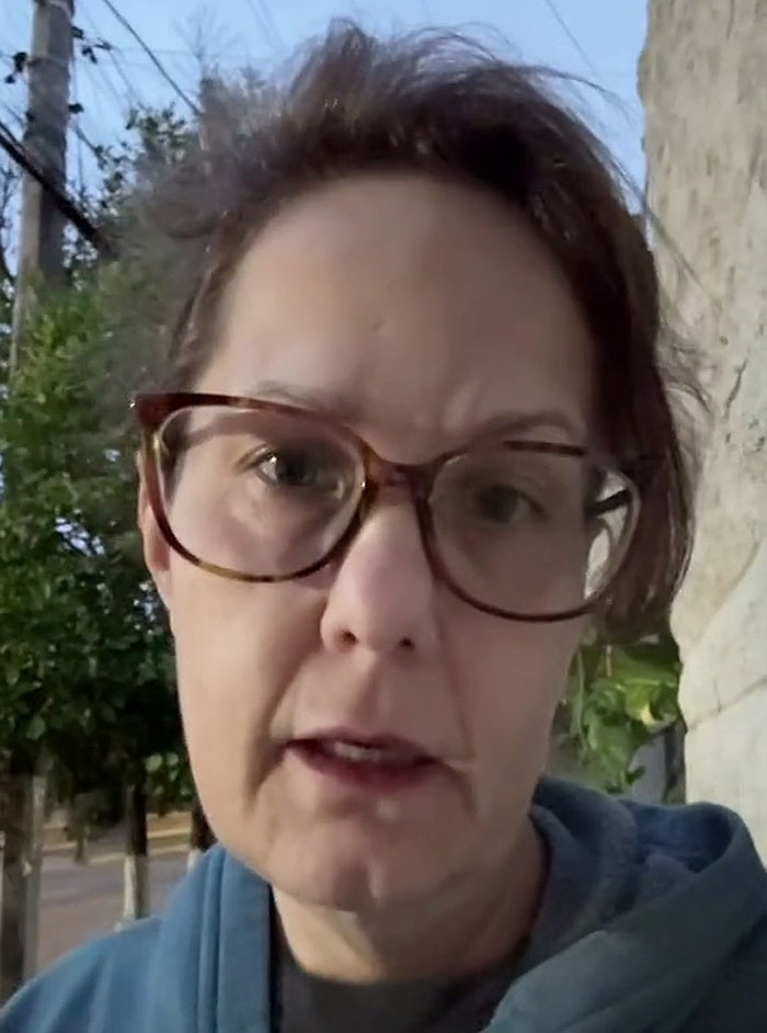 51YO Documents Progress Of Her Facelift, Leaves 125 Million People Baffled Over Results