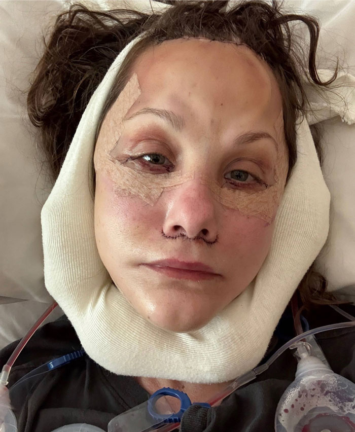 51YO Documents Progress Of Her Facelift, Leaves 125 Million People Baffled Over Results