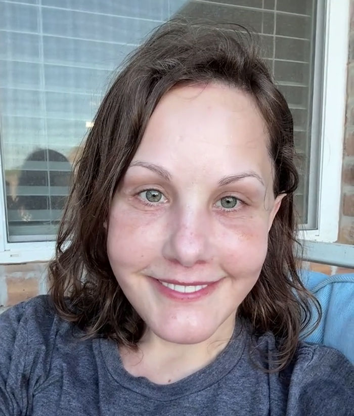 51YO Documents Progress Of Her Facelift, Leaves 125 Million People Baffled Over Results
