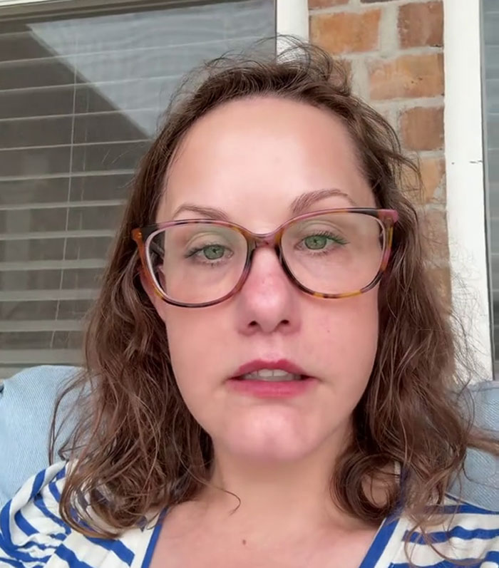 51YO Documents Progress Of Her Facelift, Leaves 125 Million People Baffled Over Results