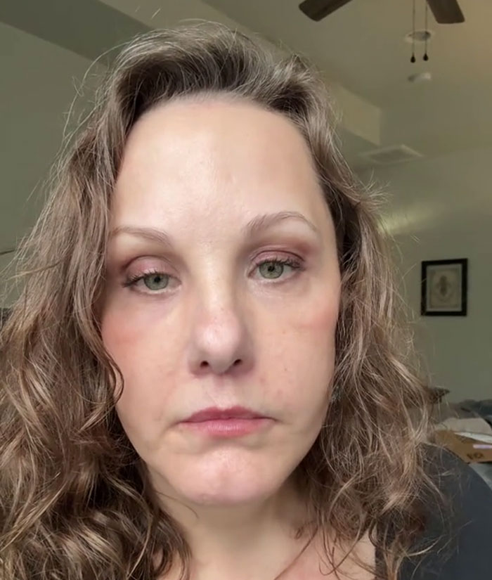 51YO Documents Progress Of Her Facelift, Leaves 125 Million People Baffled Over Results