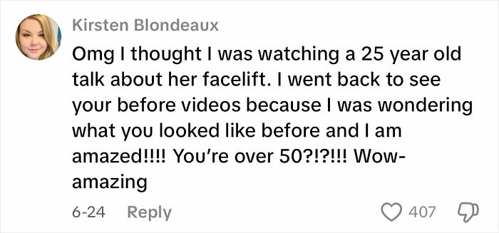 51YO Documents Progress Of Her Facelift, Leaves 125 Million People Baffled Over Results