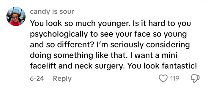 51YO Documents Progress Of Her Facelift, Leaves 125 Million People Baffled Over Results