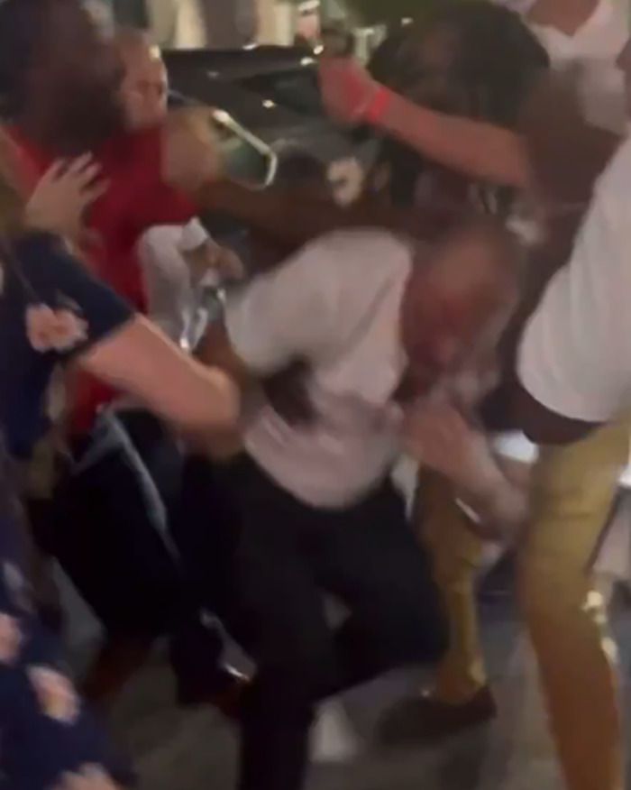 Gruesome Photos Of Cincinnati Brawl Victim’s Swollen Face Spark Outrage As Racial Tensions Erupt