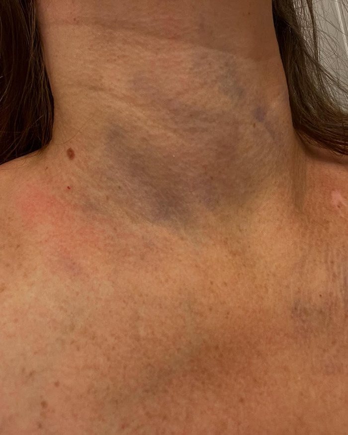 Gruesome Photos Of Cincinnati Brawl Victim’s Swollen Face Spark Outrage As Racial Tensions Erupt