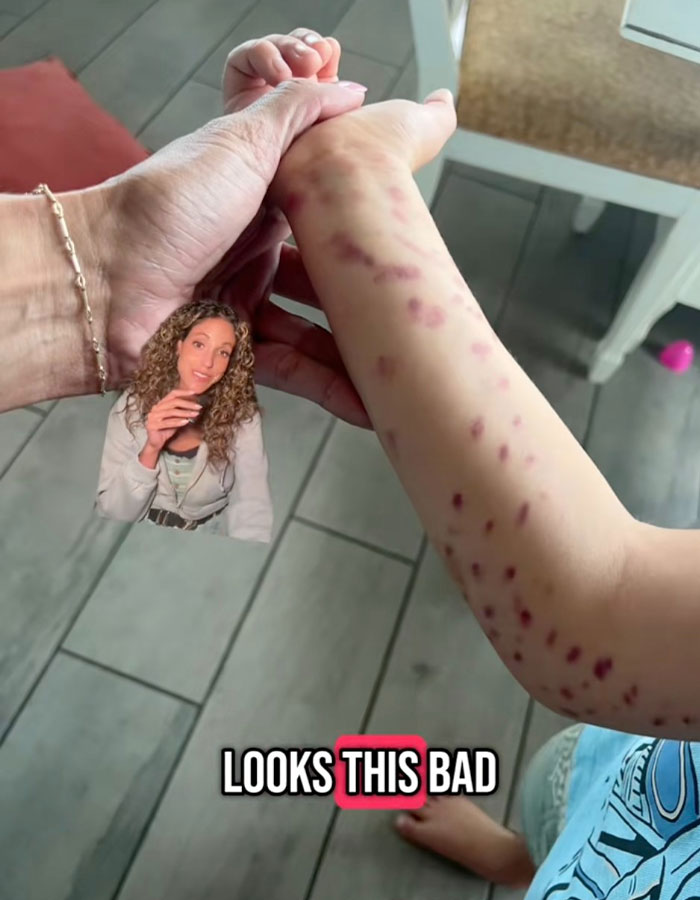 Aquarium Octopus Attacks 6-Year-Old Boy And Turns White The Next Time He Visits