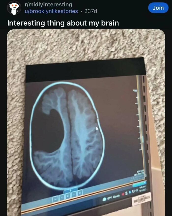 66 Memes For All Of Us With A Broken Sense Of Humor
