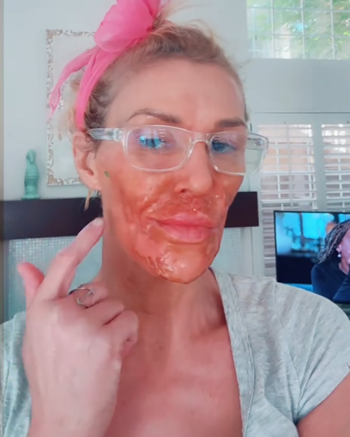 Brandi Glanville Chemically Burns Her Face Desperately Trying To Remove &#8216;Parasite&#8217;