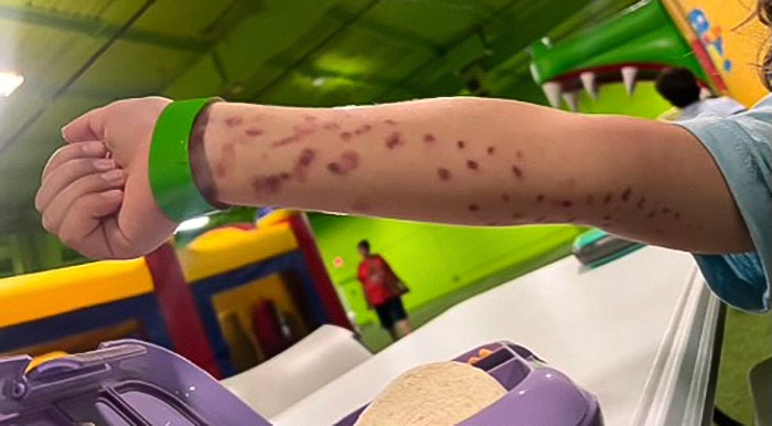 Mom Of 6YO Boy Who Was Attacked By Octopus Accuses Aquarium Of Lying After Viral Incident
