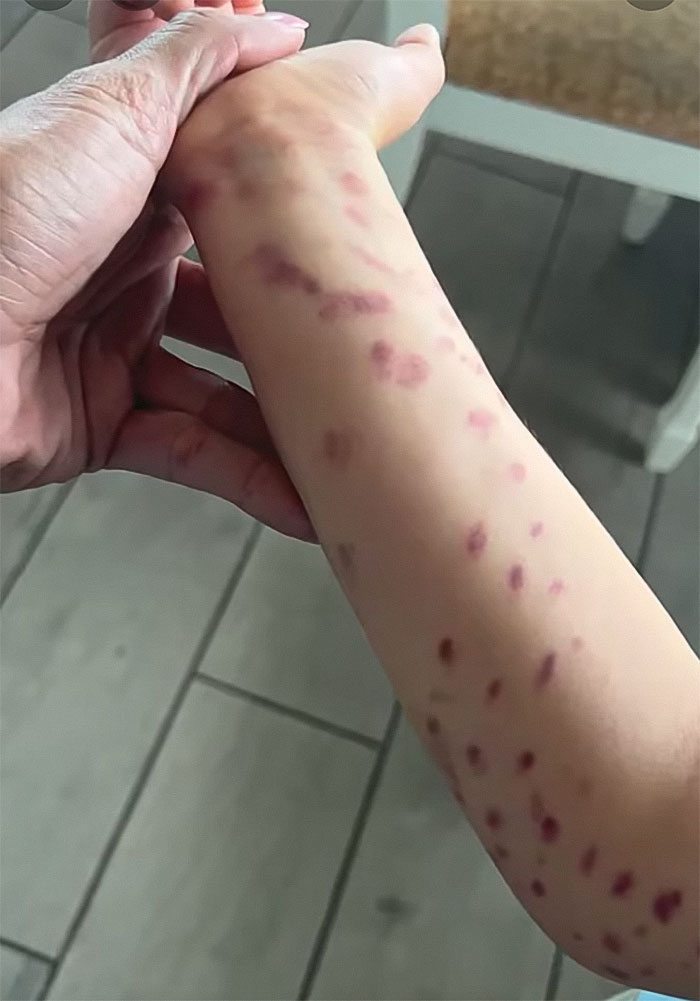 Mom Of 6YO Boy Who Was Attacked By Octopus Accuses Aquarium Of Lying After Viral Incident