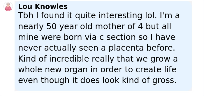 Calvin Harris Divides Fans After Posting Graphic Placenta Photos in Birth Announcement