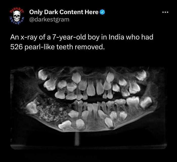 ‘Darkest Page On Instagram’: 75 Creepy Stories To Spook You And Your Friends