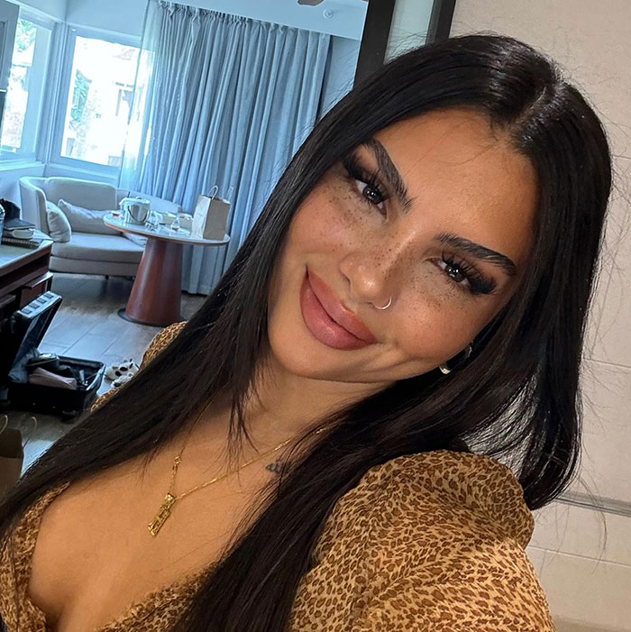 Love Island Contestants’ Overfilled Faces Fuel Concerns Over Filler Use In Young Adults