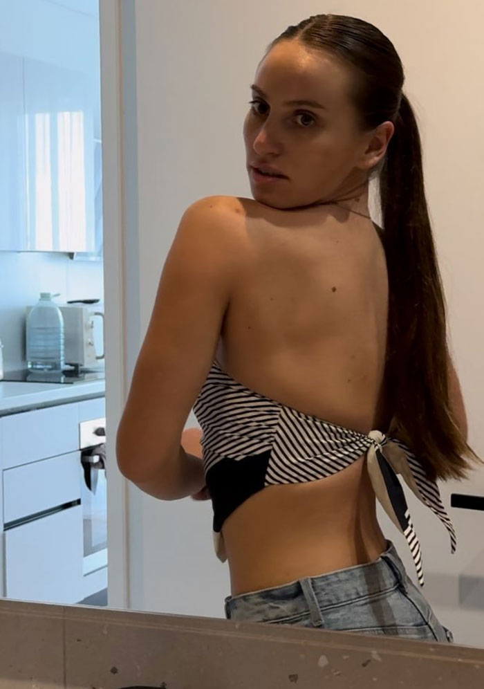 Viral Nicki Minaj Stiletto Challenge Ends In 32-Year-Old Woman Fracturing Her Spine