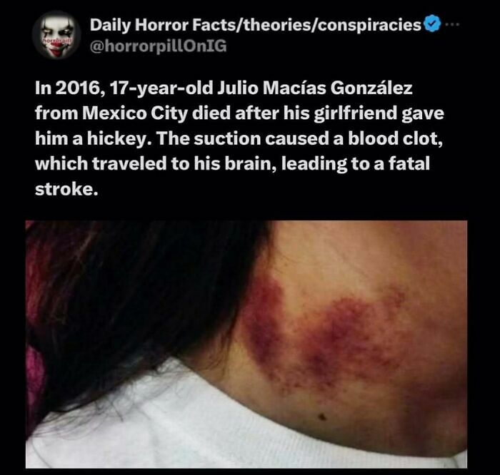 69 Terrifying Stories, Facts And Images You Don’t Want To Be Scrolling Through Before Sleep